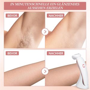 Rasoir électrique pour femmes 3-en-1, épilation sans douleur, utilisation humide et sèche, double lame, lumière LED pour le visage, les aisselles, les jambes, les zones du bikini - Product Image 4