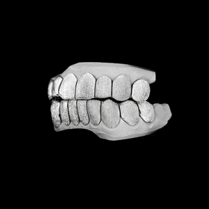 Grillz personnalisé en or texturé taille diamant pour les dents supérieures, fabriqué à la main, 6 dents croisées, 10K - Product Image 5