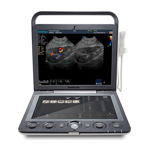 Ecógrafo SonoScape S9 S9V Doppler Color, Máquina de Ultrasonido Portátil, Escáner de Ultrasonido Veterinario - Product Image 6