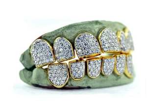 Grillz Personalizados de Color Blanco con Polvo de Diamante y Corte Estilo Hip Hop, Plata de Ley 925, Oro 10K/14K, Joyería de Lujo para Compromiso - Product Image 3