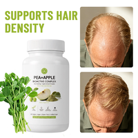 Complément alimentaire unisexe OEM ODM pour la nutrition des cheveux, anti-chute, réduit la casse des cheveux, biotine pour la croissance des cheveux, augmente l'épaisseur des cheveux.