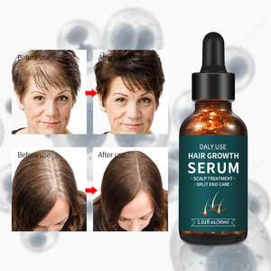 Private Label Bio-Haar wachstums serum Schnelles Haarwuchs öl Rosmarin Ingwer Ginseng Pflegende erfrischende Anti-Schuppen-Formel - Product Image 2