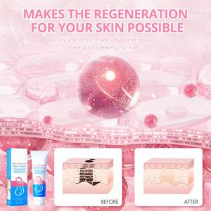 <span class=keywords><strong>Para</strong></span> Aichun Beauty, la <span class=keywords><strong>mejor</strong></span> <span class=keywords><strong>crema</strong></span> <span class=keywords><strong>corporal</strong></span> Natural <span class=keywords><strong>para</strong></span> mujeres <span class=keywords><strong>embarazadas</strong></span>, <span class=keywords><strong>crema</strong></span> hidratante suave <span class=keywords><strong>para</strong></span> eliminar estrías, <span class=keywords><strong>crema</strong></span> anticicatrices - Product Image 4