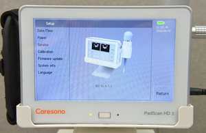 Escáner de Vejiga Caresono HD3 con Sonda N2/2.5MHz y Base, Suministros Médicos - Product Image 3