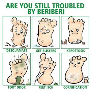 Spray <span class=keywords><strong>pour</strong></span> <span class=keywords><strong>les</strong></span> <span class=keywords><strong>pieds</strong></span> en vente chaude, apaisant <span class=keywords><strong>les</strong></span> démangeaisons, <span class=keywords><strong>antifongique</strong></span>, améliorant <span class=keywords><strong>les</strong></span> <span class=keywords><strong>pieds</strong></span> malodorants, la transpiration, la teigne, le pied d'athlète, spray <span class=keywords><strong>pour</strong></span> éliminer la teigne - Product Image 4