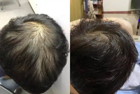 Huile capillaire OEM 100% naturelle et biologique à la rosemaine, au ricin et à l'argan 60ml – Huile nourrissante pour le cuir chevelu et la croissance des cheveux pour hommes et femmes
