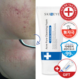 SKINEYE Mousse nettoyante pour le traitement de l'acné sans huile pure, nettoyage des pores, hydratation pour tous les types de peau - Nettoyant visage coréen - Product Image 1