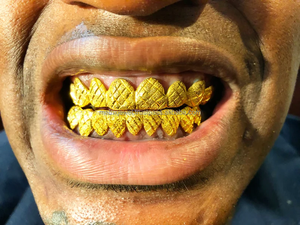 Bijoux fins Grilliz pour hommes et femmes Dents en or massif 10K 14K personnalisées Grillz Hip Hop Style Diamant Vvs - Product Image 2