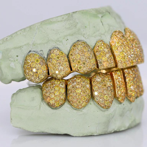 Dents en argent 925 personnalisées Hip Hop pour hommes Grillz Iced out Moissanite Diamond Grillz Dents sur chaîne en or blanc Bijoux au meilleur prix - Product Image 2