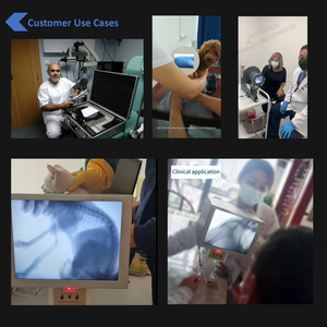 携帯型<span class=keywords><strong>X</strong></span>線装置携帯型蛍光透視装置 - Product Image 3