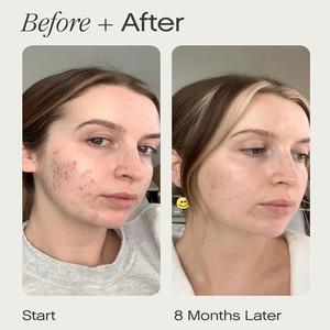 Savon nettoyant hydratant éclaircissant à l'aloe vera et au thé vert, tendance du moment, pour le mélasma et les cicatrices - Product Image 4