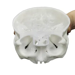 Soonser 3d Print Service Plastic Hoge Precisie 3d Geprinte Schedel Voor Medische Toepassing