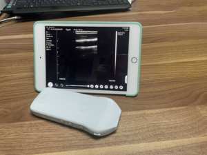 Meilleure offre pour la nouvelle sonde linéaire à ultrasons sans fil Elements 14 MHz avec port Android Type C - Product Image 2