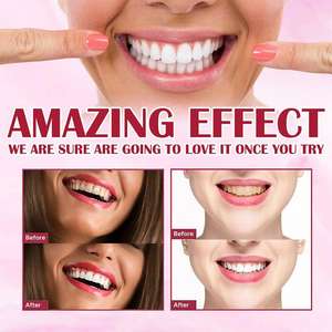 Dentifrice blanchissant probiotique SP4 pour l'élimination des taches et la mauvaise haleine, éclaircissant les dents, soin buccal sûr pour l'émail, 120g - Product Image 5