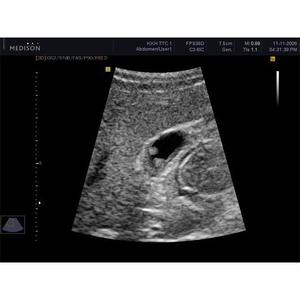 Máquina de Ultrasonido Samsung Accuvix V10 - Product Image 5