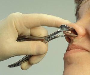 เครื่องมือผ่าตัดถ่างจมูกทำจากสเตนเลสสตีล - Product Image 6