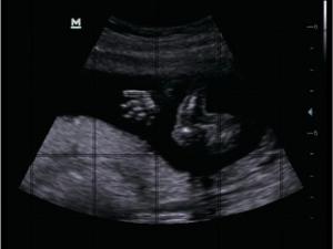 Listo para envío: Ecógrafo Mindray DP50 con sonda a elegir y 3 años de garantía - Product Image 3