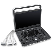 SonoScape E1V Sistema de Diagnóstico por Ultrasonido Portátil Veterinario en Blanco y Negro para Clínica Veterinaria y Uso en Granjas, Dispositivo de Imagenología en Blanco y Negro