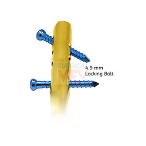 Implant chirurgical orthopédique en acier inoxydable de système d'ongle de reconstruction fémorale de verrouillage de haute qualité pour traiter le fémur - Product Image 5