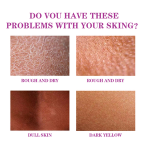 Wholesale Extra Strength Yellow Peeling <strong>Oil</strong> for <strong>Face</strong> and Body Skin Whitening Dark Scars Spots <strong>Remover</strong> for Black Skin - Product Image 6