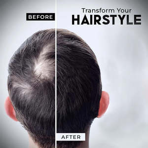 เส้นใยและอุปกรณ์ในเส้นผมเส้นใยหนาและเส้นผมแบบผสม - Product Image 2