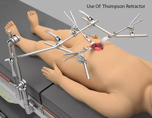 Premium Thompson Retractor Set Instrumento quirúrgico ortopédico manual completo Acero inoxidable para cirugía de trasplante de hígado - Product Image 4