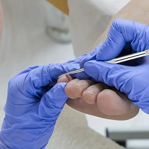 Outil professionnel pour ongles incarnés en acier inoxydable, 3 pièces, outils de nettoyage des ongles avec poignée texturée pour une expérience de pédicure améliorée - Product Image 6