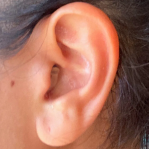 Signia 2X CIC 16-Channel Full Gain Invisible Hearing Aids Equilíbrio Tinnitus Instant Fit em Seda Vermelha e Azul Preço - Product Image 3