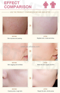 Otvena bán buôn sản phẩm chăm sóc da làm sáng da làm trắng sáng kem cho da tối - Product Image 5