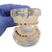 Brackets orthodontiques métalliques et en céramique, appareils dentaires orthodontiques, brackets auto-ligaturants