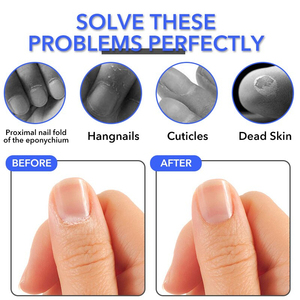 Coloré Nail Art Manucure Outil Ongle Incarné Mort Peau Remover Ciseaux Cuticule Nipper Bord Clipper pour Utilisation des Doigts - Product Image 3