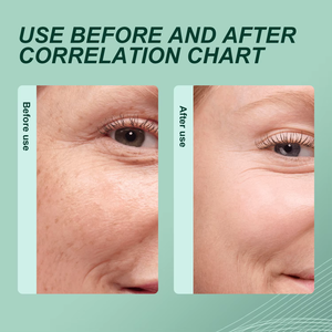 Serum pengoreksi kulit, gaya Korea perawatan kulit hiperpigmen memutihkan mengencangkan penuaan mencerahkan kulit - Product Image 4