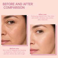 Sérum Brume Gelée aux Exosomes PDRN Marque Blanche avec Huile Essentielle de Rose Hydratant et Raffermissant pour le Visage 100ml OEM ODM
