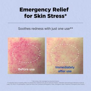 ISOI ACNI Dr. 1st Control Tonic 130mL Cuidado DE LA PIEL coreano Hidratante Hidratación profunda Calmante Tratamiento facial diario Hidratante - Product Image 4