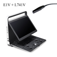 Ecógrafo Veterinario SonoScape E1V con Sonda Rectal L741V, Maleta y Cubierta de Teclado para Reproducción y Cría Equina