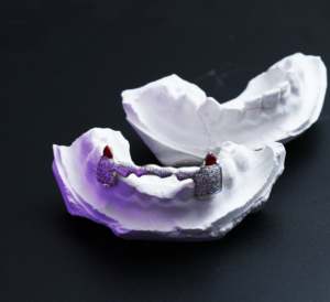 2023 à la mode unisexe luxe 10k or massif dents gril Provence personnalisable pierre principale diamant Fine Piercing bijoux personnalisé - Product Image 5