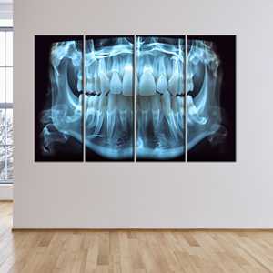 ของตกแต่งผนังรูปกายวิภาคฟันสมัยใหม่: ภาพพิมพ์บนผ้าใบสำหรับสำนักงานทันตแพทย์,4P: ภาพพิมพ์แบบห่อหุ้ม - Product Image 1