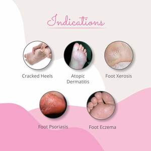 Footvital Foot Cream con mantequilla hidratante Kokum para talones secos, ásperos, agrietados y agrietados, cuidado de invierno, reparación de pies, Cream-50gm - Product Image 5