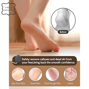 Professional Double Sided Callus Remover <b>Foot</b> <b>Filer</b> Beech Wood <b>Foot</b> Scrubber Pedicure <b>Foot</b> File Pedicure Scrubber - Product Image 5