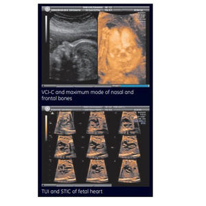 Appareil d'échographie GE Voluson 730 d'occasion, OEM/ODM, portable, pour obstétrique/gynécologie et imagerie générale - Product Image 4