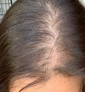 <b>Hair</b> <b>Topper</b> for <b>Woman</b> with Raw Indian <b>Hair</b> - Product Image 1