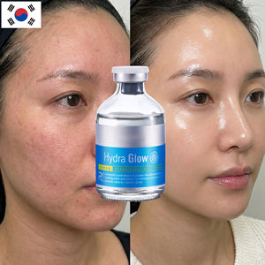 Suero Facial de Ácido Hialurónico Hidratante Profundo con Esencia de Microbioma Fermentado de 650000 ppm, Marca Privada OEM ODM, para el Cuidado de la Piel Seca - Product Image 5