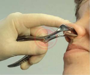 เครื่องถ่างโพรงจมูกเครื่องตรวจทางจมูกทำจากสเตนเลสสตีล - Product Image 3