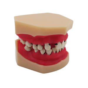 Modelo Educativo de Enseñanza Dental, Modelo de Enfermedad Periodontal - Product Image 6