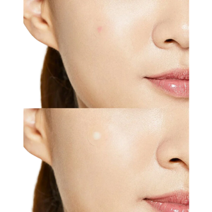 แผ่นแปะสิวคอสอาร์เอ็กซ์ 1 แพ็ค (24 ชิ้น) - Product Image 2