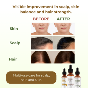 Cuidado del Cuero Cabelludo Sensible con Aceite de Jojoba, Textura Líquida Ligera de Rápida Absorción para Raíces Débiles y Cabello Fino, Empaque Personalizado - Product Image 4