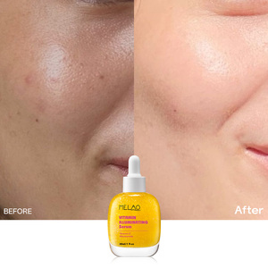 Suero <span class=keywords><strong>Iluminador</strong></span> con Vitamina OEM, Cuidado de la Piel, Fortalece la Barrera Cutánea, Hidrata, Ácido Hialurónico, Vitamina C, Suero Facial - Product Image 5