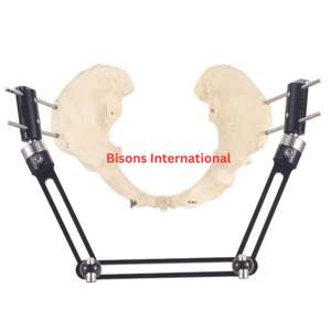 Bisons อุปกรณ์ตรึงกระดูกทางการแพทย์ทำจากสแตนเลสอุปกรณ์ตรึงกระดูกกระดูกเชิงกรานภายนอกช่วยประหยัดเวลาในการผ่าตัด - Product Image 3