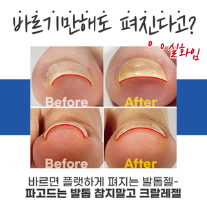 KRALLE Gel Base Coat 6ml, Uso Profesional en Salón, Esmalte de Uñas en Gel Curado con UV, Libre de TPO y HEMA, Corrección de Uñas Encarnadas para el Cuidado de las Uñas - Product Image 4