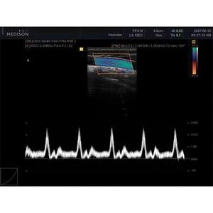 Appareil d'échographie SonoAce X8 avec support OEM/ODM, écran LCD 17 pouces, origine Italie - Product Image 5